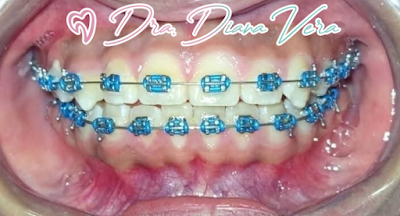 Dental Inn - Nezahualcoyotl