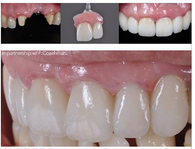 Dental St. Engracia.