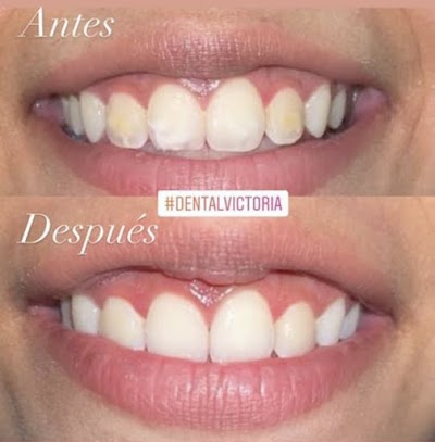 Dental victoria