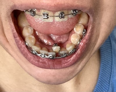 Dental World San Pedro