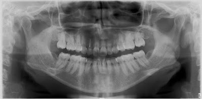 Dentista | Dra. Daniela Rojas Pichón