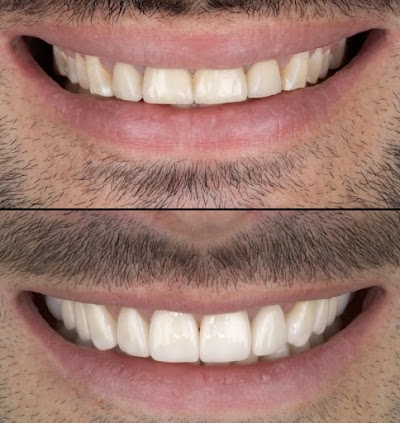 Dentista en Cdmx. Dr Yamil Romero