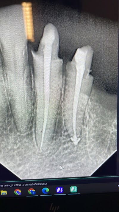 Dentista en Culiacán LabsEndo Endodoncia Dolor Dental e Implantes Dentales Dr kevin DDS