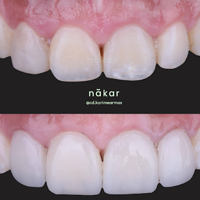 Dentista Jardines del Pedregal Dra. Karime Armas