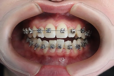 Dr. Marco Roldán, Dentista - Odontólogo