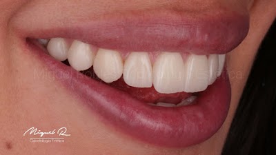 Dr. Miguel Robles - Odontología Estética