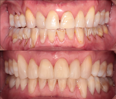 Dra. Aide Montserrat Orozco Gutierrez, Dentista - Odontólogo