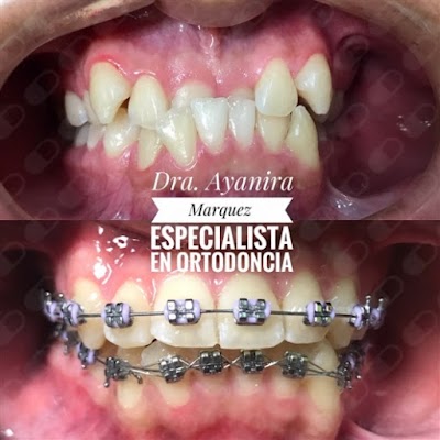 Dra. Ayanira Marquez Sifontes, Dentista especialista en ortodoncia y ortopedia dentomaxilar