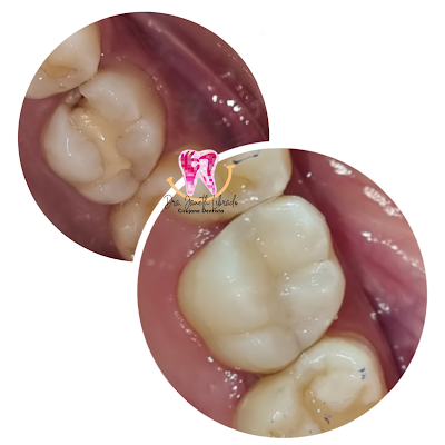 Dra. Janeth Librado - Cirujano Dentista