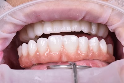 Enamelex Clinica Dental rosarito