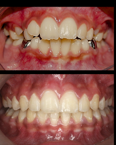 LUX Dental Studio TECAMACHALCO