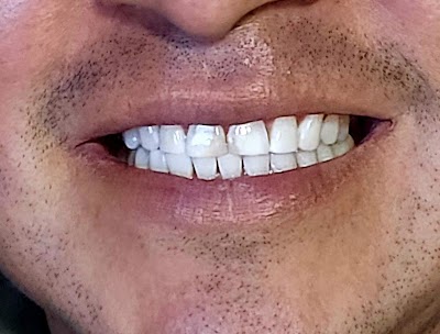 Montalvo Dental Dentista Tijuana