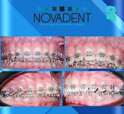 NOVADENT/DENTISTA. Suc. Chetumal