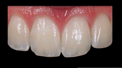 Odontología Estética e Implantología