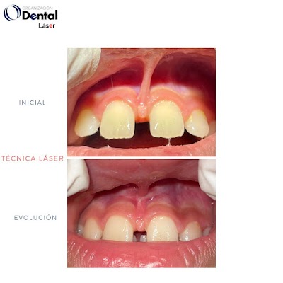 Organizacion Dental Laser