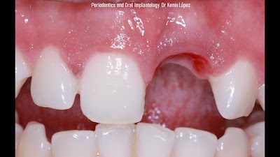 Periodoncia e Implantes Dentales. Dra Kenia Danae Lopez