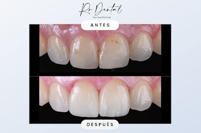 RO Dental - Dentistas en Cancún