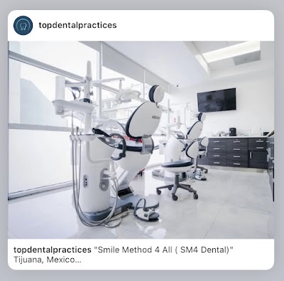 SM4 Smile Method For All