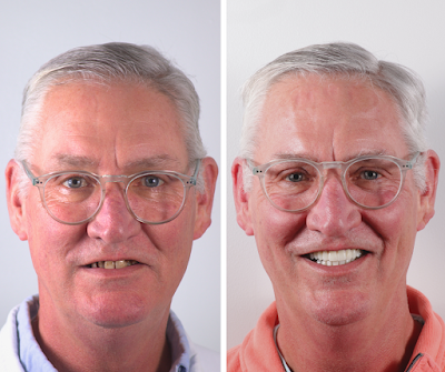 Smile Center Los Algodones