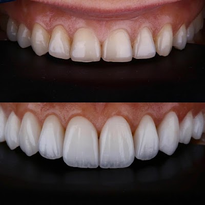 Smile Vallarta Dentist